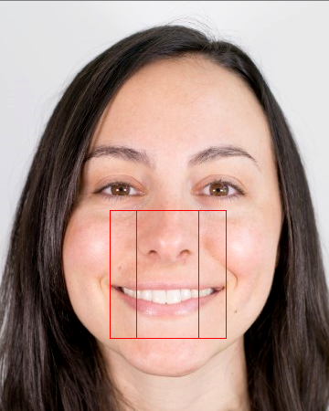 julia-calderone-smile-nose-width